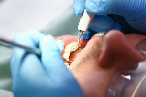 Best Emergency Gum Pain Relief  in Oakwood, PA
